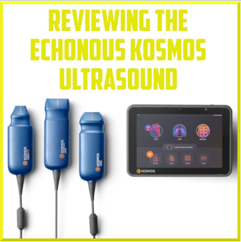 Beoordeling van een ultrasone scanner voor MSK-scans