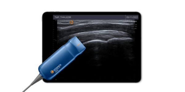 KOSMOS-LEXSA ultrageluid scanner voor MSK ultrageluid scannen van het bewegingsapparaat