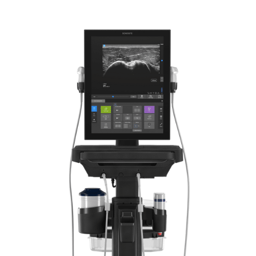 De Sonosite ST is een echografiescanner met een groot scherm die eenvoudig te bedienen en te reinigen is.