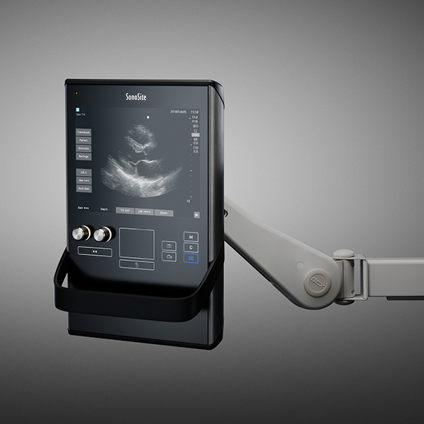 SonoSite SII