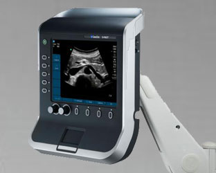 SonoSite-echoscanner