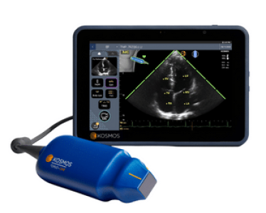Kosmos handheld ultrasound scanner van Secma